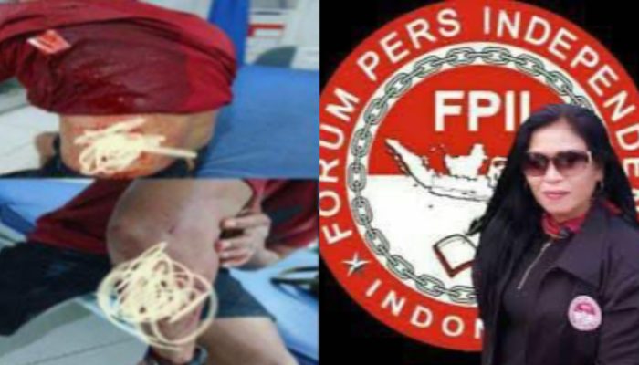 Ketua Presidium FPII Desak Kapolri Usut Tuntas Kasus Penikaman Jurnalis di Banggai Laut