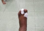 *Jurnalis Alami Kecelakaan Kerja Saat Perbaiki Motor*