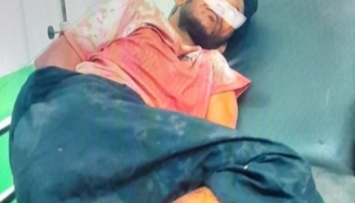 Pria Bersenjata Tajam Serang Ibu dan Anak di Dalam Rumah