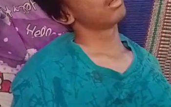 derita warga cirebon butuh uluran tangan, jalani pengobatan dan dirujuk ke bandung 3 IMG 20261002 WA0074 1