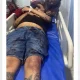 Ngeri Kali! Donny Pacek Diduga Ditembak OTK di Tanjung Morawa, Mobil Yaris Oleng hingga Hantam Pedagang